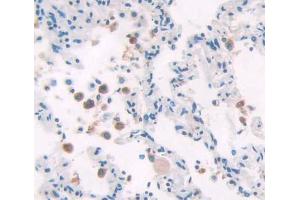 Used in DAB staining on fromalin fixed paraffin- embedded lung tissue (POLD1 Antikörper  (AA 41-254))
