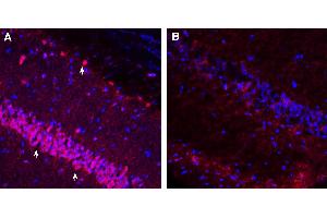Expression of SORCS2 in rat hippocampus.