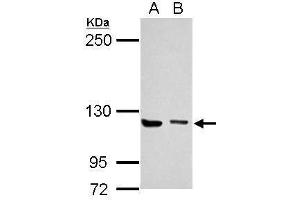 WB Image Sample (30 ug of whole cell lysate) A: Jurkat B: K562 5% SDS PAGE antibody diluted at 1:1000 (UNC13D Antikörper  (C-Term))