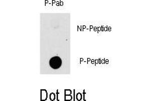 Image no. 1 for anti-P21-Activated Kinase 1 (PAK1) (pThr423) antibody (ABIN358352) (PAK1 Antikörper  (pThr423))