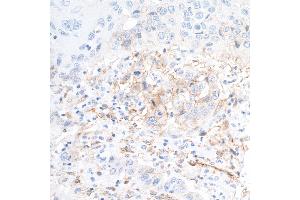 Immunohistochemistry (IHC) image for anti-5'-Nucleotidase, Ecto (CD73) (NT5E) (AA 27-552) antibody (ABIN7449540) (Rekombinanter CD73 Antikörper  (AA 27-552))