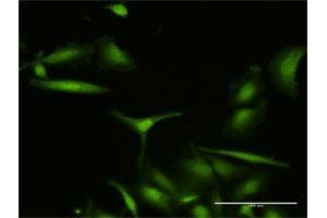 Immunofluorescence of purified MaxPab antibody to S100A7 on HeLa cell. (S100A7 Antikörper  (AA 1-101))