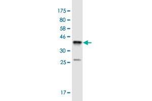 Western Blot detection against Immunogen (36. (SSX4 Antikörper  (AA 91-188))