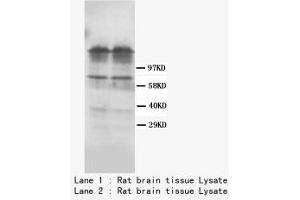 Image no. 1 for anti-Dopamine Receptor D1 (DRD1) (C-Term) antibody (ABIN1493058) (Dopamine Receptor d1 Antikörper  (C-Term))