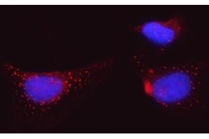 IF analysis of BI-1/TMBIM6 using anti-BI-1/TMBIM6 antibody (ABIN7603199). (Bax Inhibitor 1 Antikörper  (N-Term))