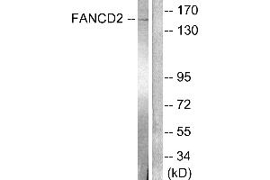 Western blot analysis of extracts from HT-29 cells, treated with Calyculin A (50ng/ml, 30mins), using FANCD2 (Ab-222) antibody (#B0427). (FANCD2 Antikörper  (Ser222))