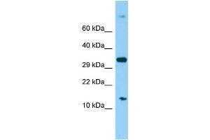 Host: Rabbit Target Name: MRPS16 Sample Type: 293T Whole Cell lysates Antibody Dilution: 1.