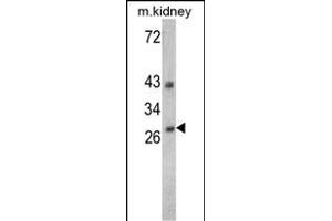 Western blot analysis of ENDOG Antibody (C-term) (Cat. (Endonuclease G Antikörper  (C-Term))