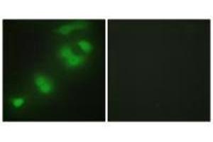 Immunofluorescence analysis of HepG2 cells, using CREBZF antibody. (CREBZF Antikörper)