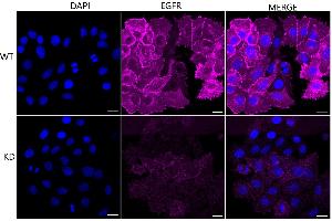 Immunocytochemical staining of HepG2 cells using EGFR antibody (ABIN7798479), 1:1,000), Top panel: wild-type (WT), Bottom panal: EGFR shRNA knockdown (KD). (Rekombinanter EGFR Antikörper)