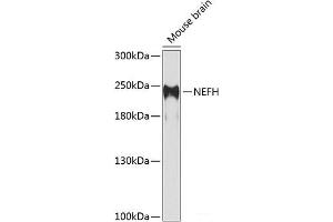 Western blot analysis of extracts of Mouse brain using NEFH Polyclonal Antibody at dilution of 1:1000. (NEFH Antikörper)