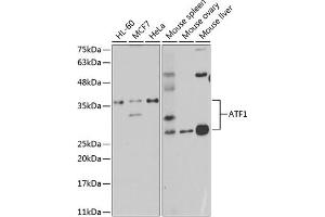 Western blot analysis of extracts of various cell lines, using  antibody (ABIN6127376, ABIN6137228, ABIN6137229 and ABIN6221472) at 1:1000 dilution. (AFT1 Antikörper  (AA 1-210))
