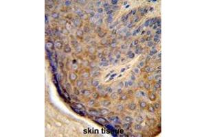 Formalin-fixed and paraffin-embedded human skin tissue reacted with TCHP Antibody (Center), which was peroxidase-conjugated to the secondary antibody, followed by DAB staining. (TCHP Antikörper  (Middle Region))