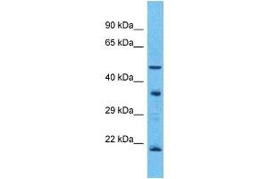 Western Blotting (WB) image for anti-Olfactory Receptor, Family 5, Subfamily T, Member 3 (OR5T3) (C-Term) antibody (ABIN2791781) (OR5T3 Antikörper  (C-Term))