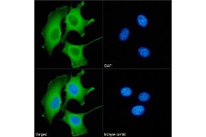 Immunofluorescence staining of fixed NIH3T3 cells with anti-Galectin 9 antibody RG9-35. (Rekombinanter Galectin 9 Antikörper)
