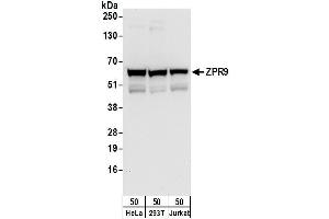anti-Zinc Finger Protein 622 (ZNF622) (AA 125-175) antibody