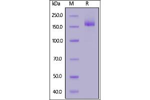 SARS-CoV-2 S protein, His Tag on  under reducing (R) condition.