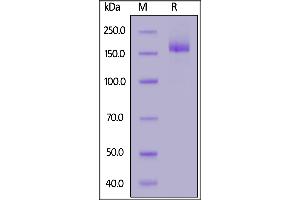 SARS-CoV-2 S protein, His Tag on  under reducing (R) condition. (SARS-CoV-2 Spike Protein (P.1 - gamma) (His tag))