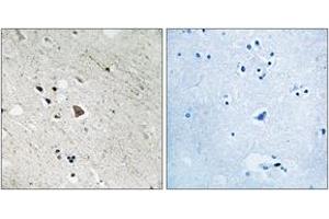 Immunohistochemistry analysis of paraffin-embedded human brain, using FLT3 (Phospho-Tyr969) Antibody. (FLT3 Antikörper  (pTyr969))