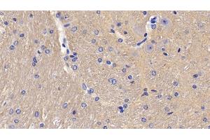 Detection of CD90 in Mouse Cerebellum Tissue using Polyclonal Antibody to Cluster of Differentiation 90 (CD90) (CD90 Antikörper  (AA 20-131))