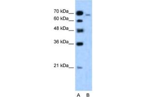Western Blotting (WB) image for anti-Afadin (MLLT4) antibody (ABIN2460899) (Afadin Antikörper)