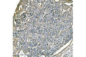 IHC analysis of ATG16L1 using anti-ATG16L1 antibody (ABIN7602244). (ATG16L1 Antikörper  (AA 66-359))