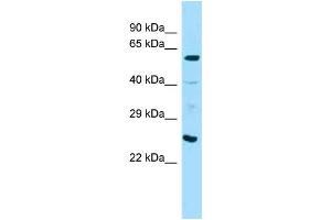Western Blotting (WB) image for anti-Angiopoietin 1 (ANGPT1) (C-Term) antibody (ABIN2789373) (Angiopoietin 1 Antikörper  (C-Term))