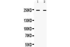 Western Blotting (WB) image for anti-AT Rich Interactive Domain 1A (SWI-Like) (ARID1A) (AA 1021-1053), (Middle Region) antibody (ABIN3043527)