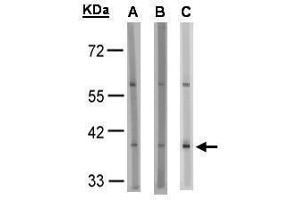 WB Image Sample(30 μg of whole cell lysate) A:HeLa S3 , B:MOLT4, C:Raji , 10% SDS PAGE antibody diluted at 1:1000 (SUCNR1 Antikörper)