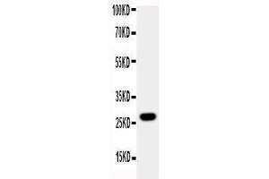 Observed bind size: 27KD (Aquaporin 8 Antikörper  (N-Term))