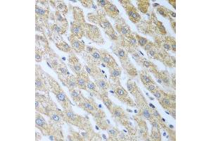 Immunohistochemistry of paraffin-embedded human liver using Eif2ak2 antibody. (EIF2AK2 Antikörper  (AA 1-270))