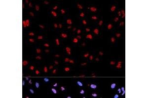 Immunofluorescence analysis of U2OS cells using Phospho-MEF2C(S396) Polyclonal Antibody (MEF2C Antikörper  (pSer396))