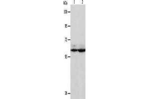 Gel: 8 % SDS-PAGE, Lysate: 40 μg, Lane 1-2: Hela cells, Jurkat cells, Primary antibody: ABIN7130740(PSMD3 Antibody) at dilution 1/300, Secondary antibody: Goat anti rabbit IgG at 1/8000 dilution, Exposure time: 5 seconds (PSMD3 Antikörper)