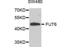 Western blot analysis of extracts of SW480 cells, using FUT6 antibody (ABIN5972052) at 1/1000 dilution. (FUT6 Antikörper)