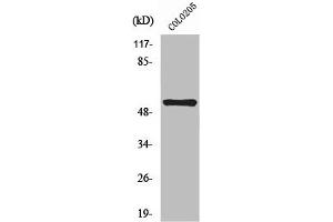 Western Blot analysis of COLO205 cells using NK-3R Polyclonal Antibody
