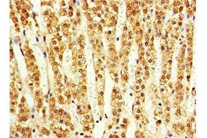 Immunohistochemistry of paraffin-embedded human adrenal gland tissue using ABIN7143179 at dilution of 1:100 (ACVR1C/ALK7 Antikörper  (AA 22-113))