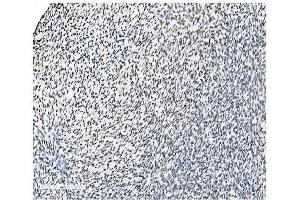 IHC analysis of NRF1 using anti-NRF1 antibody (ABIN7600874). (NRF1 Antikörper  (AA 246-503))