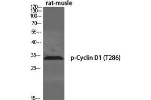Western Blot (WB) analysis of specific cells using Phospho-Cyclin D1 (T286) Polyclonal Antibody. (Cyclin D1 Antikörper  (pThr286))