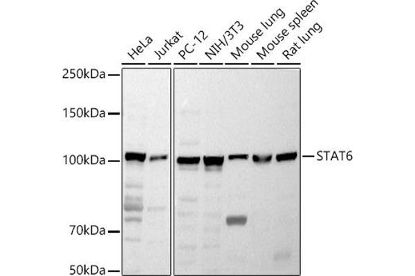 STAT6 Antikörper  (AA 1-180)