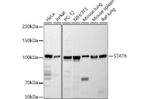 Western blot analysis of extracts of various cell lines, using ST antibody (ABIN6128541, ABIN6148581, ABIN6148582 and ABIN6213980) at 1:1000 dilution. (STAT6 Antikörper  (AA 1-180))