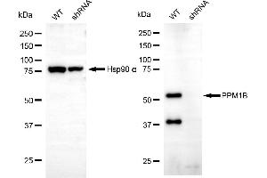 Western blotting analysis using PPM1B antibody (ABIN7800033). (PPM1B Antikörper)