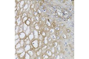 Immunohistochemistry of paraffin-embedded human esophagus using UBE2A antibody (ABIN6132760, ABIN6149782, ABIN6149784 and ABIN6223686) (40x lens). (UBE2A Antikörper  (AA 1-152))