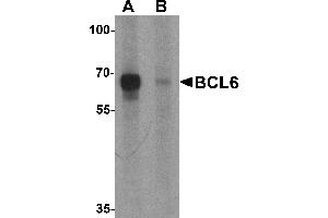 Western blot analysis of BCL6 in rat lung tissue lysate with Bcl6 antibody at 1 µg/mL in (A) the absence and (B) the presence of blocking peptide (BCL6 Antikörper  (Middle Region))