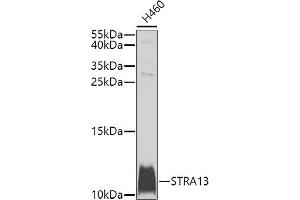 Western blot analysis of extracts of H460 cells, using STR antibody (ABIN6133039, ABIN6148631, ABIN6148632 and ABIN6225238) at 1:1000 dilution. (STRA13 Antikörper  (AA 1-63))