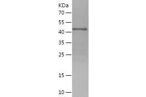 Western Blotting (WB) image for Dachshund 1 (DACH1) (AA 552-758) protein (His-IF2DI Tag) (ABIN7284108) (DACH1 Protein (AA 552-758) (His-IF2DI Tag))