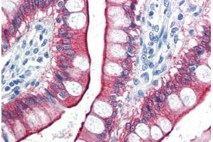 Human Small Intestine (formalin-fixed, paraffin-embedded) stained with VIL1 antibody ABIN337303 at 10 ug/ml followed by biotinylated anti-mouse IgG secondary antibody ABIN481714, alkaline phosphatase-streptavidin and chromogen. (VILL Antikörper)