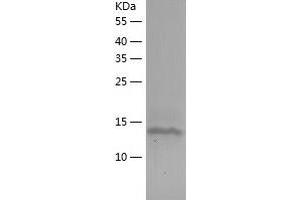 Western Blotting (WB) image for GABA(A) Receptor-Associated Protein (GABARAP) (AA 1-117) protein (His tag) (ABIN7123032) (GABARAP Protein (AA 1-117) (His tag))