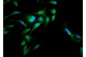 Immunofluorescence staining of Hela cells with ABIN7167302 at 1:185, counter-stained with DAPI. (RAB35 Antikörper  (AA 1-201))