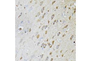 Immunohistochemistry of paraffin-embedded rat brain using ND5 antibody (ABIN5975833) at dilution of 1/100 (40x lens).