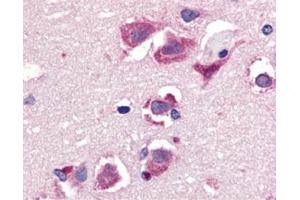 Immunohistochemistry of TRAIL in human brain tissue with this product at 20 μg/ml. (TRAIL Antikörper  (C-Term))